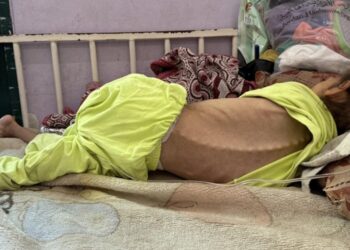 WHO Desak Akses Bantuan yang Aman dan Berkelanjutan saat Kelaparan Memburuk di Gaza