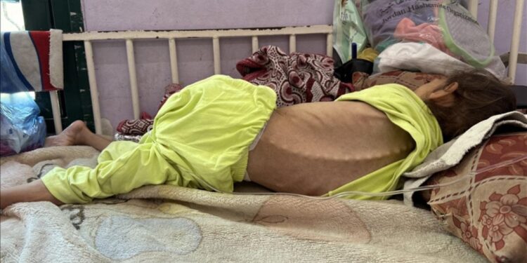 WHO Desak Akses Bantuan yang Aman dan Berkelanjutan saat Kelaparan Memburuk di Gaza