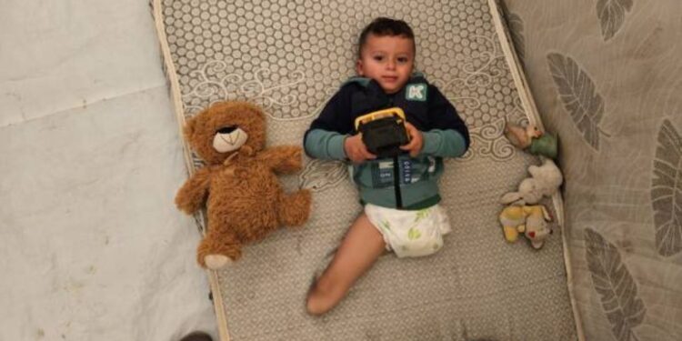 Satu Generasi yang Hilang di Gaza: Luka Fisik, Trauma Jiwa, dan Cacat Seumur Hidup