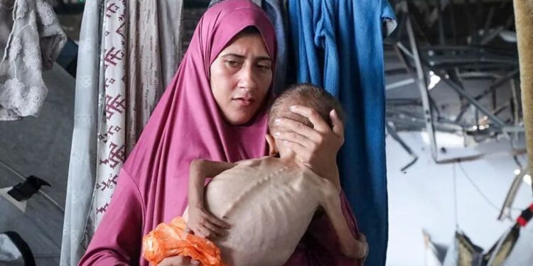 Anak-Anak Gaza Tidur dalam Keadaan Lapar: UNICEF Peringatkan Krisis Gizi dan Penyakit