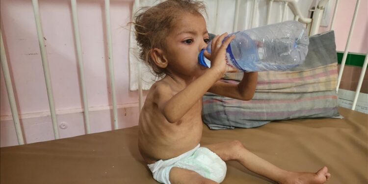 PBB Laporkan Hampir 95.000 Kasus Gizi Buruk Anak di Jalur Gaza Sepanjang 2025