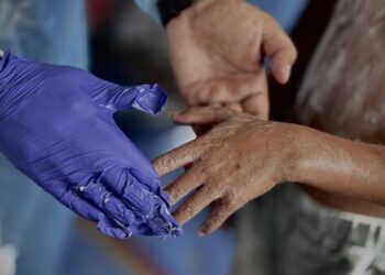 Infeksi Kulit Merebak di Gaza, UNRWA Peringatkan Krisis Obat