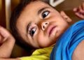 Kelaparan dan Penyakit Kulit Menyerang Anak-Anak Gaza di Kamp Pengungsian