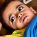 Kelaparan dan Penyakit Kulit Menyerang Anak-Anak Gaza di Kamp Pengungsian