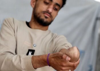 “Saya Merasa Kehilangan Hidup Saya”: Korban Amputasi di Gaza Berjuang untuk Bisa Bergerak di Tengah Krisis Alat Medis