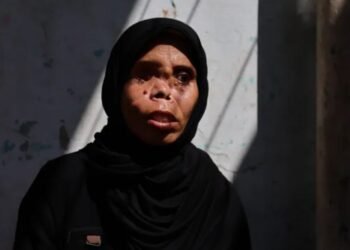 Kehilangan Mata dan Putrinya, Perjuangan Najwa Bangkit di Tengah Luka Perang Gaza
